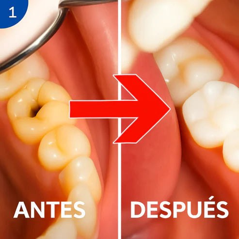 LLEVA GRAN OFERTA 2X1 🦷 Beamach® | Regenera tus Dientes Desde Casa y Dile Adiós a la Sensibilidad